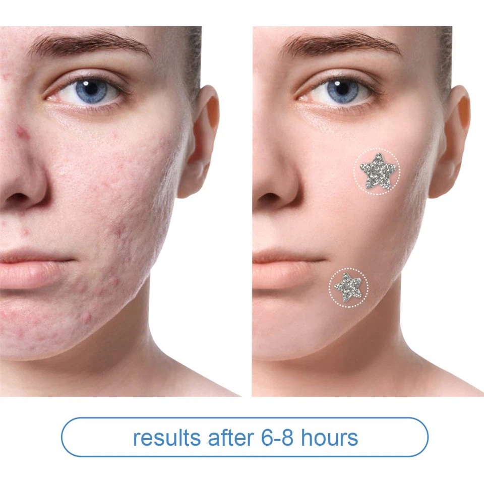 OEM Star Hydrocolloid Acne Pimple Patch For Skin Care